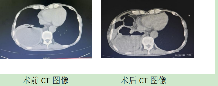 1758783515332083001.png image.png